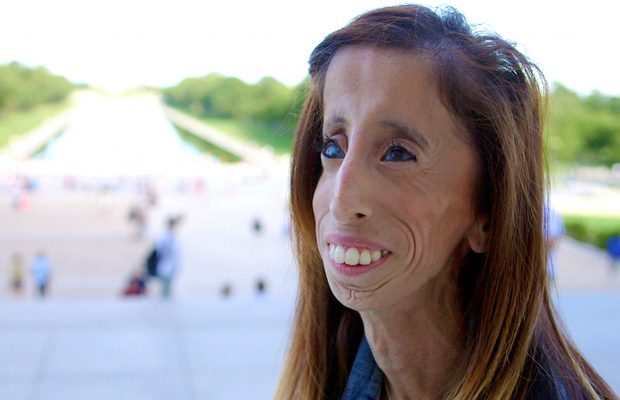 Lizzie Velasquez