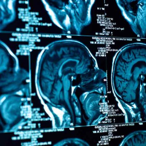 Neurosurgeon