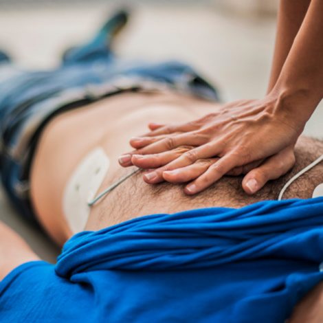 CPR