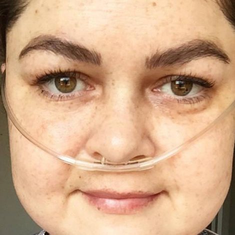 Brent Lindeque Alice Vogt Good Things Guy Cliffcentral Double Lung Transplant