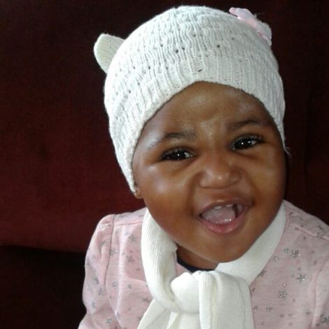Lethabo Clubfoot Steps