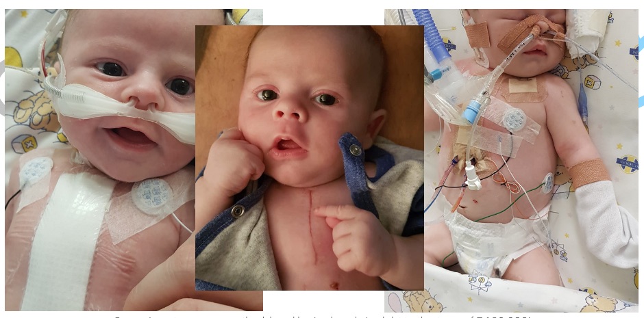 A brave newborn's big fight is warming the hearts of South Africans