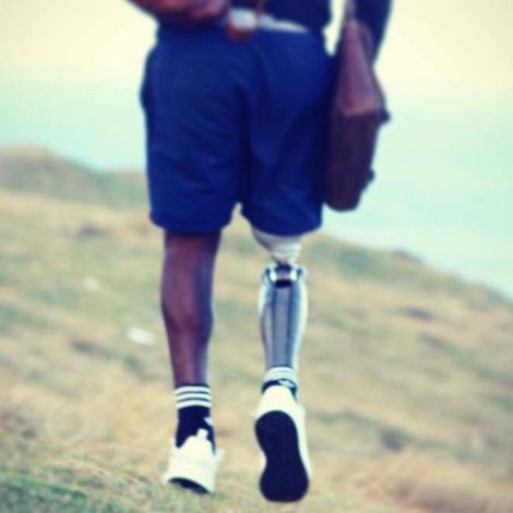 Watch: I lost my leg but found my purpose! South African shares inspiring story!