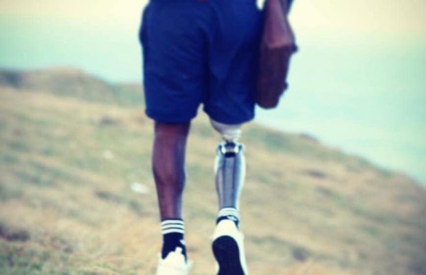 Watch: I lost my leg but found my purpose! South African shares inspiring story!