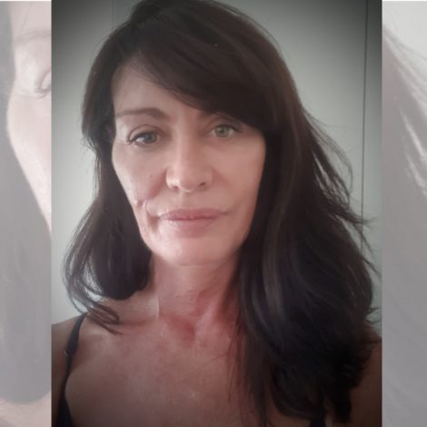Fourways woman shot in face while driving, writes heartfelt open letter after surviving Samantha Wade