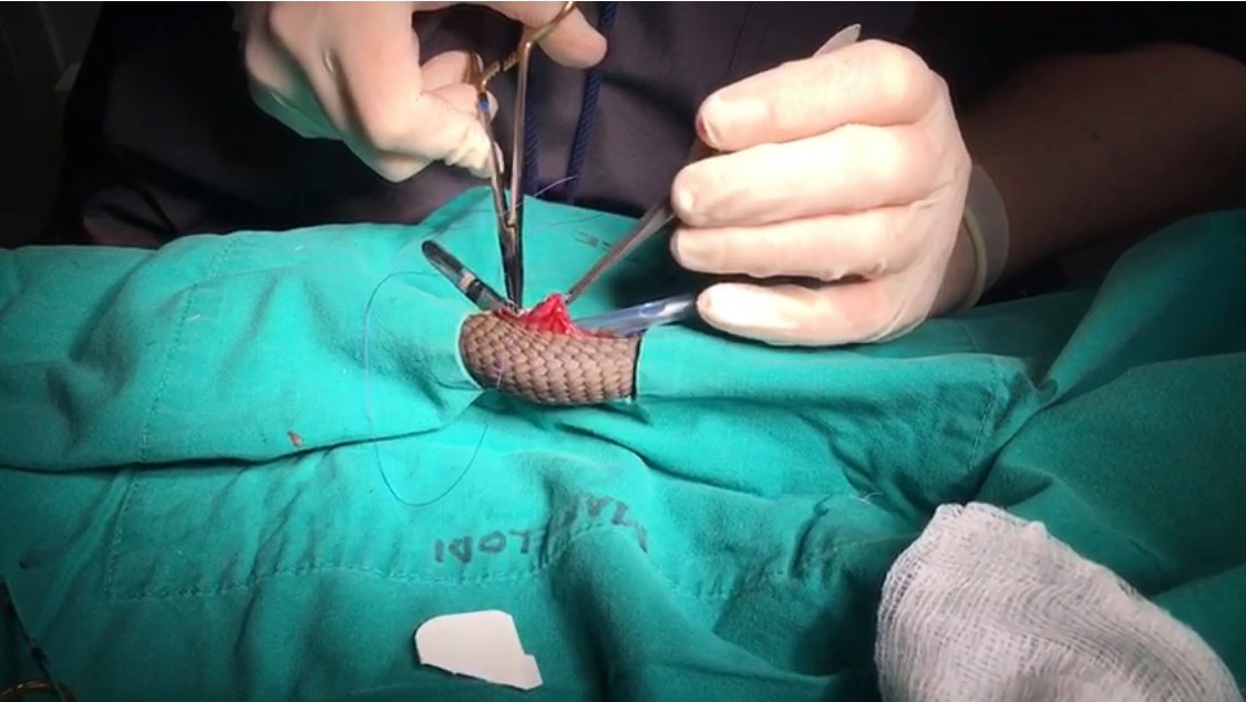 Surgery