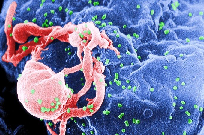 HIV