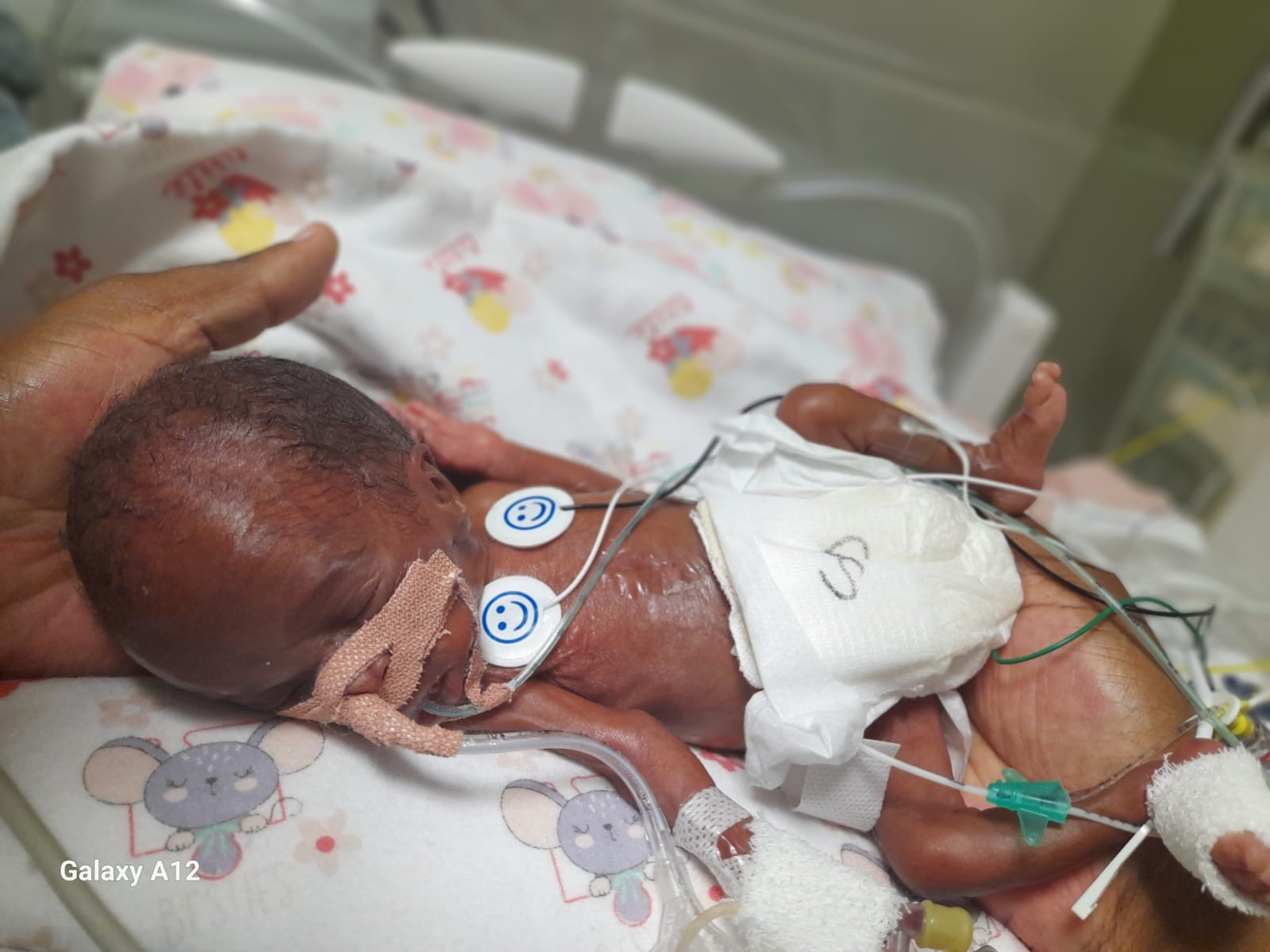 Tiny Fighter, Big Miracle: Tshiamo’s Journey to Her First Birthday