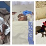 Baby Xihluke’s Miracle: Medical Heroes Unite to Mend Her Little Heart