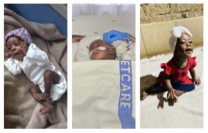 Baby Xihluke’s Miracle: Medical Heroes Unite to Mend Her Little Heart