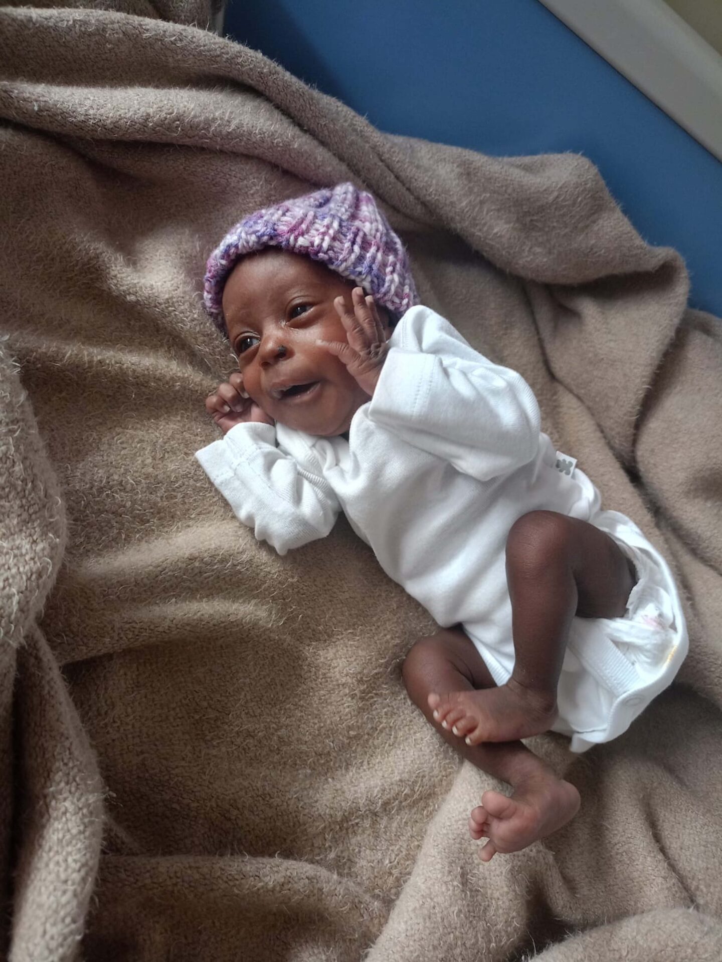 Baby Xihluke’s Miracle: Medical Heroes Unite to Mend Her Little Heart