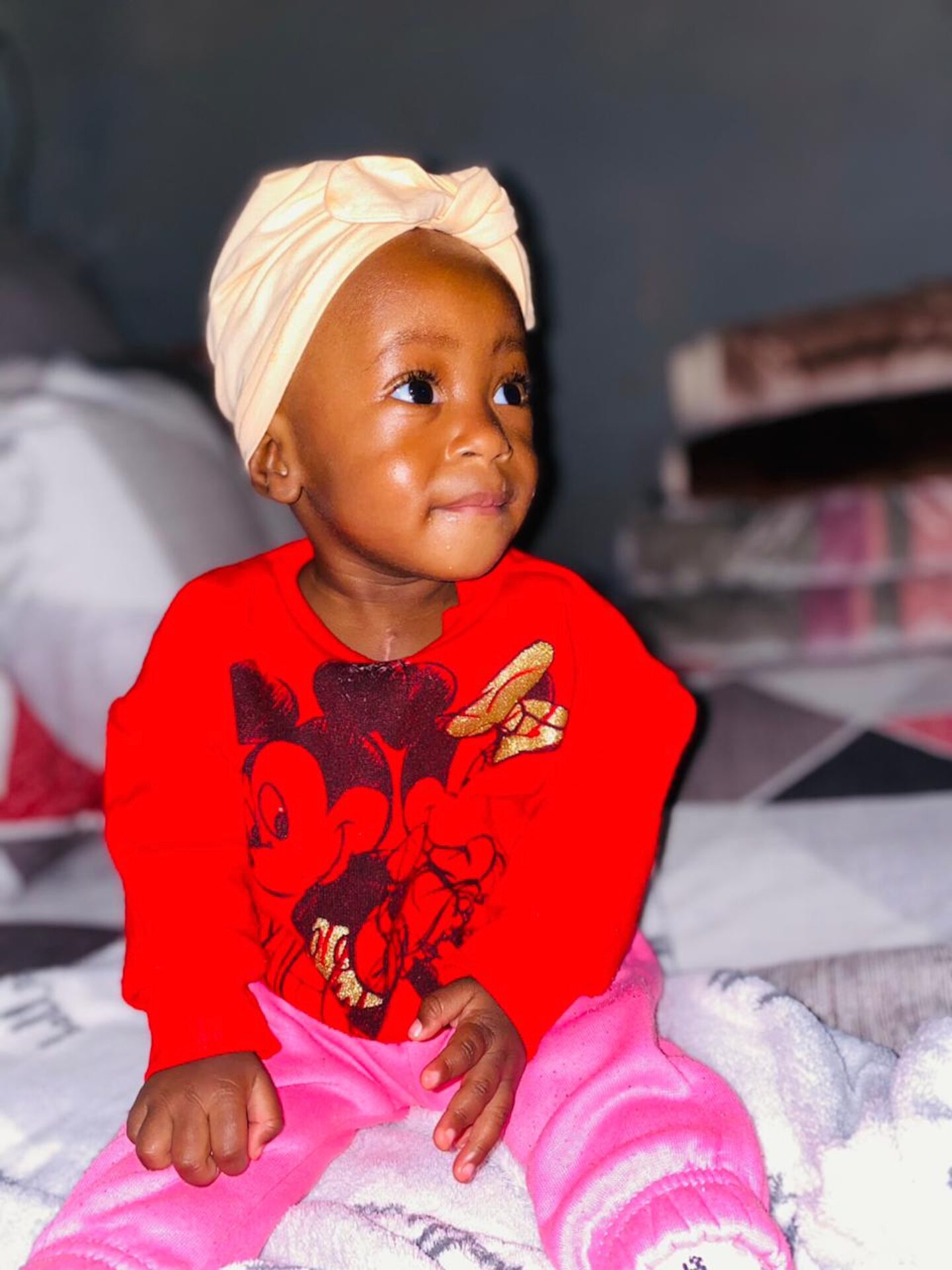 Baby Xihluke’s Miracle: Medical Heroes Unite to Mend Her Little Heart