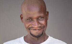 A New Smile Didn't Just Change His Look, It Changed Everything for Zivezile