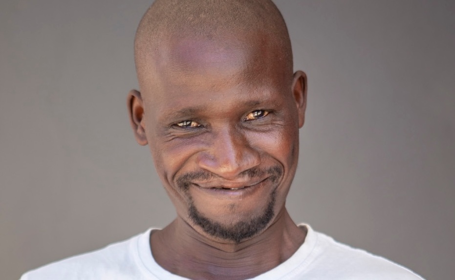 A New Smile Didn't Just Change His Look, It Changed Everything for Zivezile