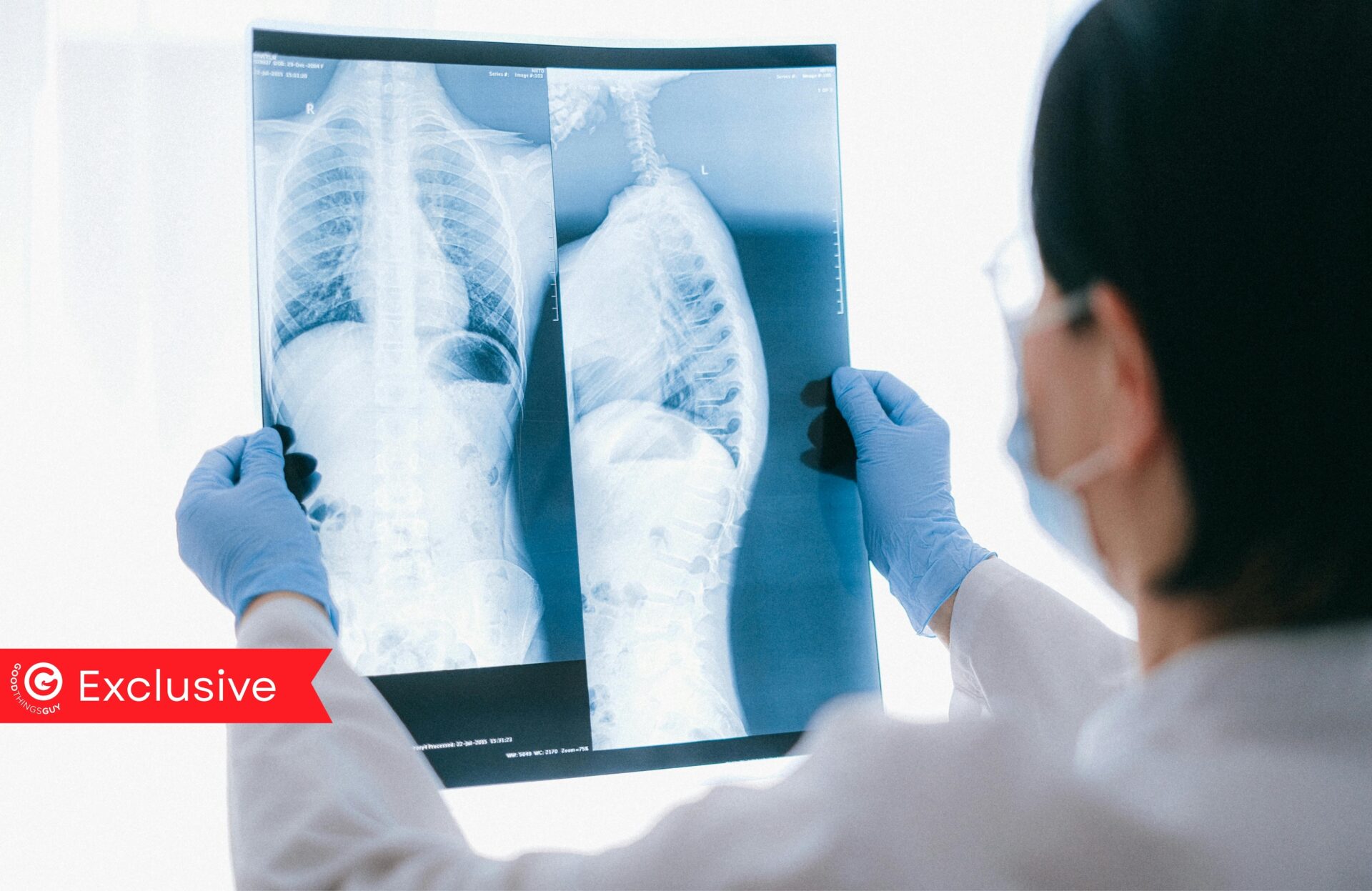 Ahead of World TB Day, a new episode of 'Good Things with Brent Lindeque' is bringing one of South Africa’s biggest health stories into clearer focus.