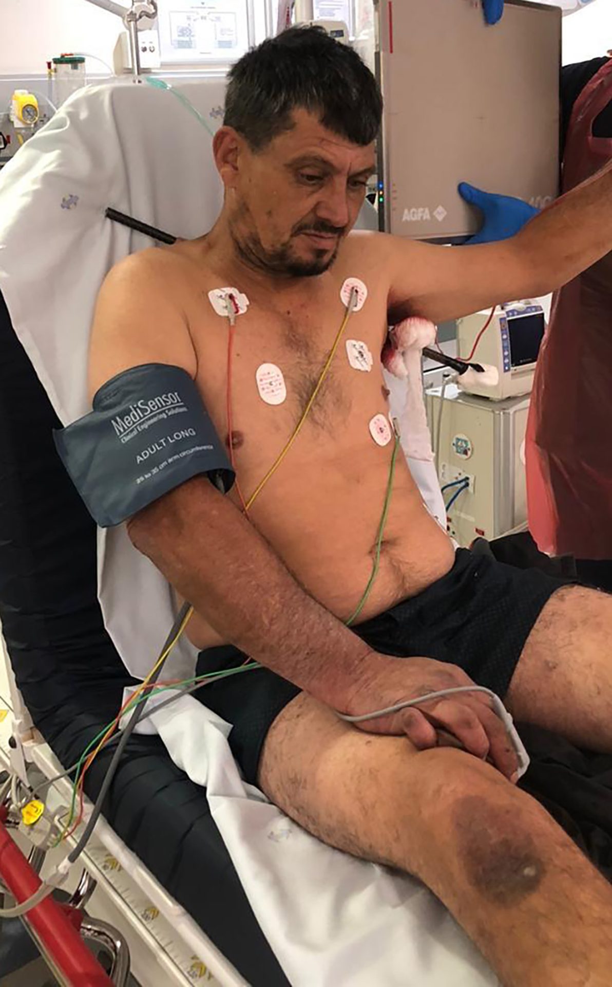Cape Town Mechanic Survives Steel Rod Through His Chest!