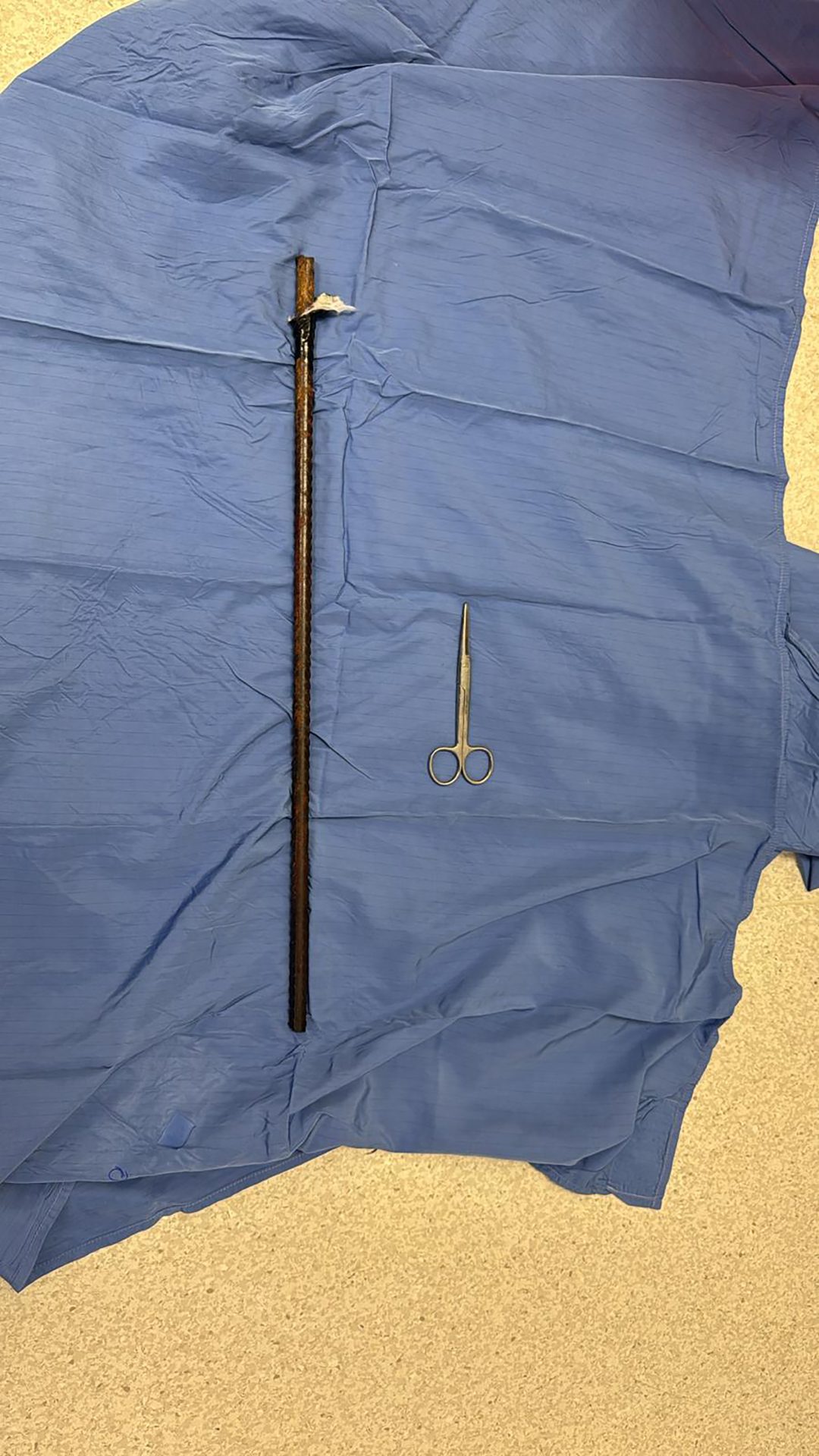 Cape Town Mechanic Survives Steel Rod Through His Chest!